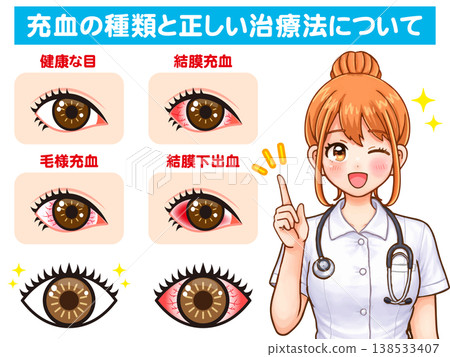 護士講解眼睛乾澀發紅的插圖 138533407