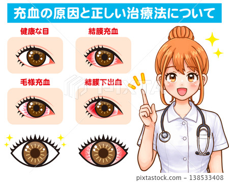 插圖素材2:一位護士講解眼睛乾澀和發紅的症狀 插圖素材2:一位護士講解眼睛乾澀和發紅的症狀 138533408