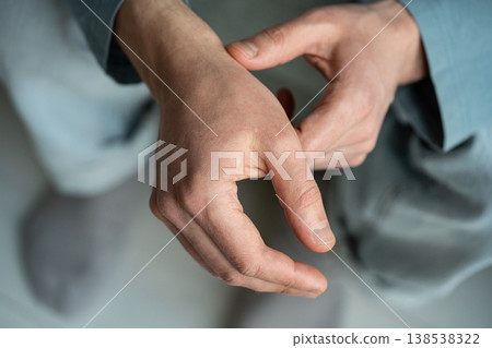Male showing hands with body dehydration symptoms in winter season, frostbite and skin dryness. Male showing hands with body dehydration symptoms in winter season, frostbite and skin dryness. 138538322