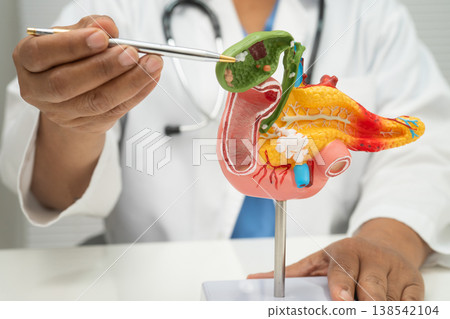 Pancreatitis, pancreatic cancer, Asian doctor with pancreas, gallbladder and bile duct human anatomy model at hospital. Pancreatitis, pancreatic cancer, Asian doctor with pancreas, gallbladder and bile duct human anatomy model at hospital. 138542104