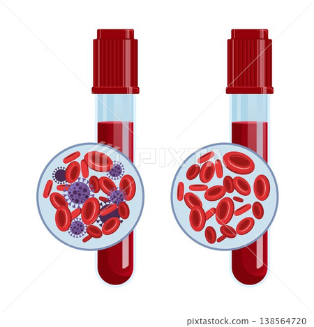 Healthy and Infected Blood Cells Comparison with Virus Illustration. Healthy and infected blood samples with red blood cells and viruses, concept of infection, diagnostics, and laboratory analysis. Healthy and Infected Blood Cells Comparison with Virus Illustration. Healthy and infected blood samples with red blood cells and viruses, concept of infection, diagnostics, and laboratory analysis. 138564720