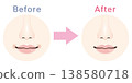 Before and After Illustrations of dullness around the mouth 138580718