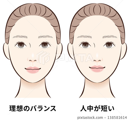 A comparison chart of ideal facial balance and a shorter philtrum. A comparison chart of ideal facial balance and a shorter philtrum. 138581614