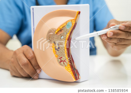doctor holding female breast human anatomy model. 138585934