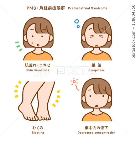 Premenstrual Syndrome (PMS) Symptoms: 4-Piece Illustration Set | Skin Problems, Drowsiness, Swelling, and Difficulty Concentrating 138604550