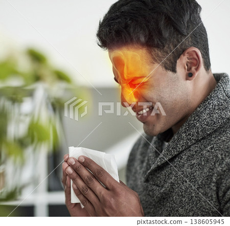 Congestion, red pain and blowing nose with a man using a tissue in his home for relief from allergies. Sick, cold or flu and a young person ill with a virus due to pollen or hay fever symptoms Congestion, red pain and blowing nose with a man using a tissue in his home for relief from allergies. Sick, cold or flu and a young person ill with a virus due to pollen or hay fever symptoms 138605945