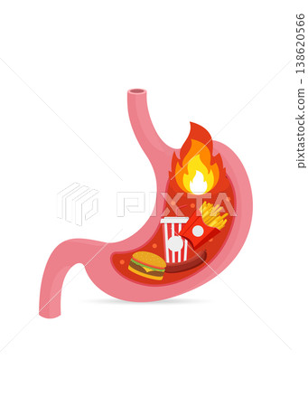 Fast Food in Stomach Causing Heartburn and Acid Reflux Stock Illustration. Fast Food in Stomach Causing Heartburn and Acid Reflux Stock Illustration. 138620566