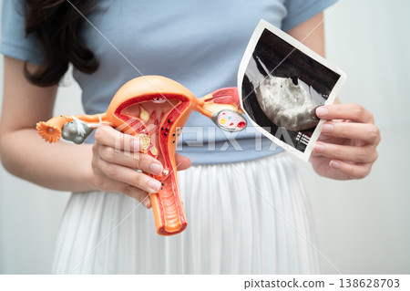 Uterus, Asian, woman holding human anatomy model. Uterus, Asian, woman holding human anatomy model. 138628703