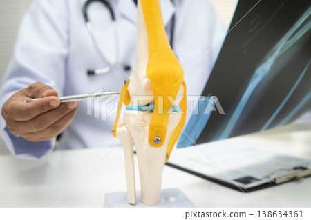 Doctor examining knee joint bone radiography xray film. Doctor examining knee joint bone radiography xray film. 138634361