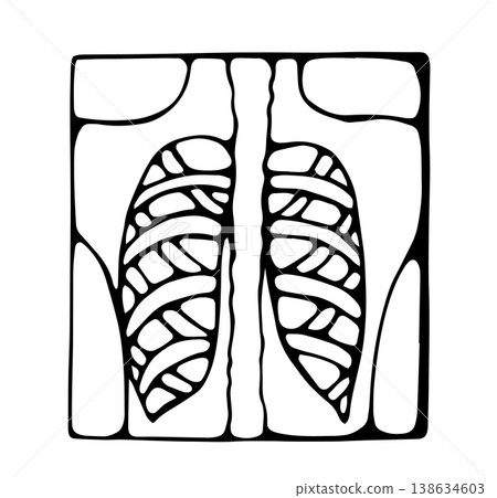Chest x ray lungs medical radiology doodle illustration 138634603