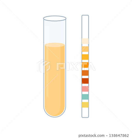 Urine sample tube and urinalysis reagent strip for kidney exam, urinary tract infection and cystitis diagnostics.  138647862