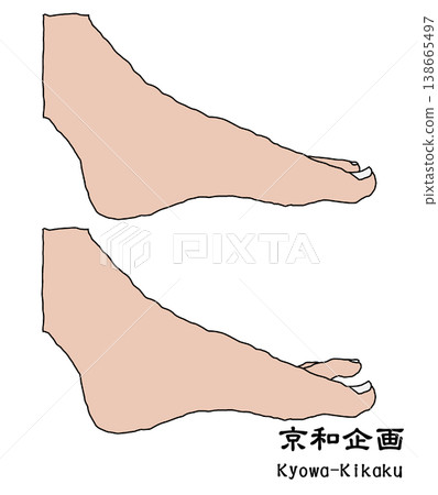 leg leg 138665497