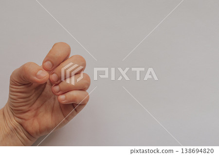Female hand with bitten short nails and dry cuticles on a white background. Close-up of unkempt fingernails needing professional manicure with large copy space on the right 138694820