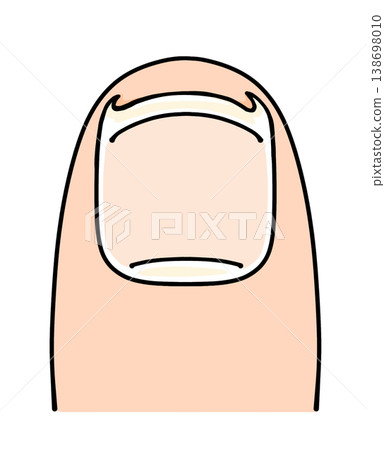 A relaxed, simple ingrown toenail treatment with solid color. 138698010