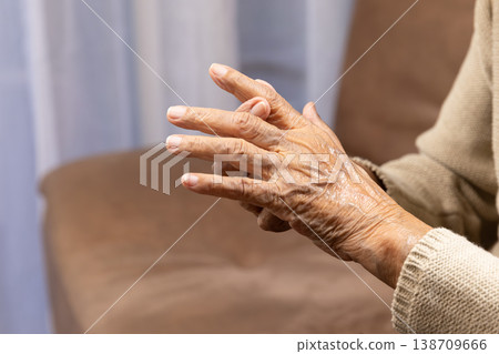 Senior woman massage finger with painful swollen gout. Senior woman massage finger with painful swollen gout. 138709666