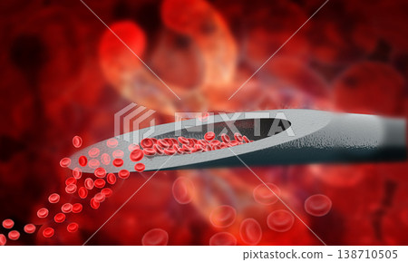 Blood on a needle on scientific background Blood on a needle on scientific background 138710505