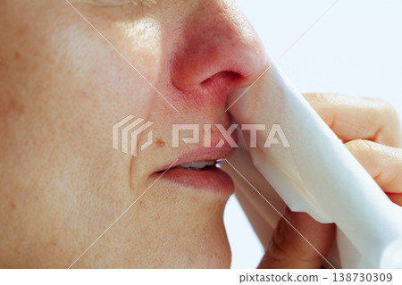 Profile of Woman Wiping Irritated Nose Profile of Woman Wiping Irritated Nose 138730309