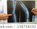Doctor examining knee joint bone radiography xray film. 138738102