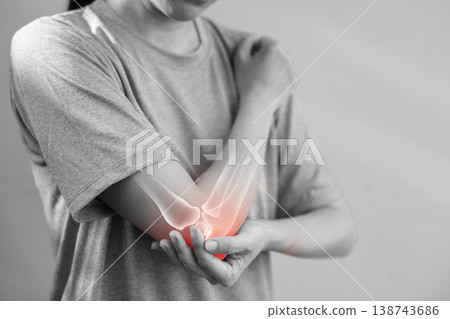Monochrome photo of woman suffering from severe elbow pain, holding her arm with a red glowing anatomical bone graphic overlay showing joint inflammation, arthritis, or injury in medical concept. 138743686