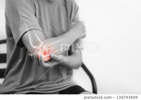 Monochrome photo of woman suffering from severe elbow pain, holding her arm with a red glowing anatomical bone graphic overlay showing joint inflammation, arthritis, or injury in medical concept. 138743689