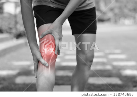 Monochrome photo of person holding painful knee with red glowing anatomical bone graphic overlay showing joint inflammation, sports injury, or severe arthritis in medical and healthcare concept. Monochrome photo of person holding painful knee with red glowing anatomical bone graphic overlay showing joint inflammation, sports injury, or severe arthritis in medical and healthcare concept. 138743693
