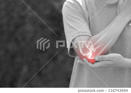 Monochrome photo of woman suffering from severe elbow pain, holding her arm with a red glowing anatomical bone graphic overlay showing joint inflammation, arthritis, or injury in medical concept. 138743694