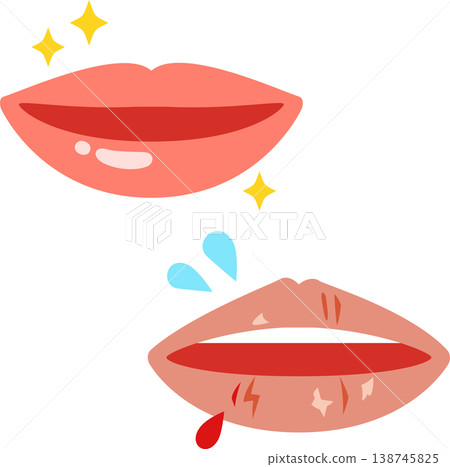Healthy lips vs. chapped lips 138745825