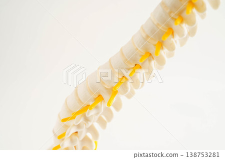 Spinal nerve and bone, Lumbar spine displaced herniated disc fragment, Model for treatment medical in the orthopedic department. Spinal nerve and bone, Lumbar spine displaced herniated disc fragment, Model for treatment medical in the orthopedic department. 138753281