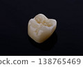 High-quality zirconia dental crown on white background. Dental ceramic crown professional dental lab 138765469