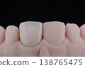 Mirror copy of central maxillary incisor, ultra thin dental ceramic veneer or crown on printed model 138765475