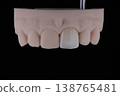 Mirror copy of central maxillary incisor, ultra thin dental ceramic veneer or crown on printed model 138765481