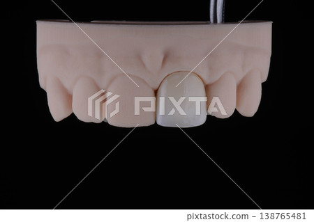 Mirror copy of central maxillary incisor, ultra thin dental ceramic veneer or crown on printed model Mirror copy of central maxillary incisor, ultra thin dental ceramic veneer or crown on printed model 138765481