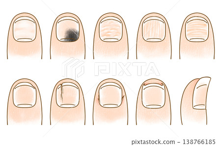 A set of loosely styled, simple, and unusually shaped nails - analog style 138766185