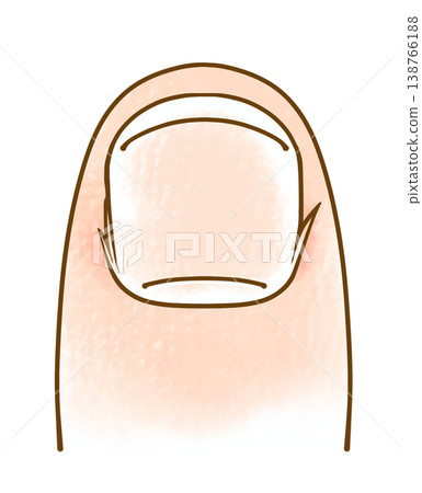 Loose, simple, slightly rough nails with a touch of analog style. Loose, simple, slightly rough nails with a touch of analog style. 138766188