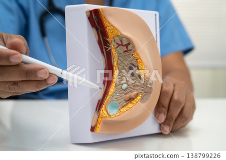 doctor holding female breast human anatomy model. 138799226