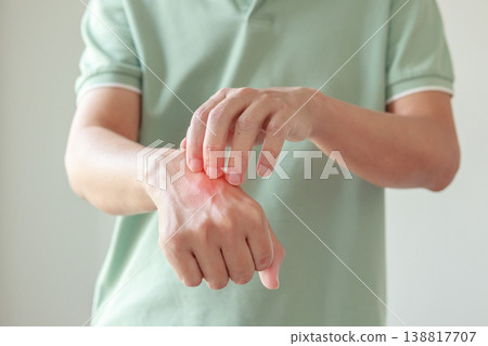 Young asian man itching and scratching on arm from allergic itchy dry skin eczema dermatitis insect bites 138817707