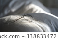 Hair Loss Problem Close Up, Fallen Hair on Pillow, Alopecia and Stress Concept 138833472