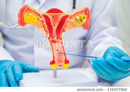 Doctor holding human uterus model for vaginal and cervix pap smear check up in the obstetrics and gynecology. Doctor holding human uterus model for vaginal and cervix pap smear check up in the obstetrics and gynecology. 138857968