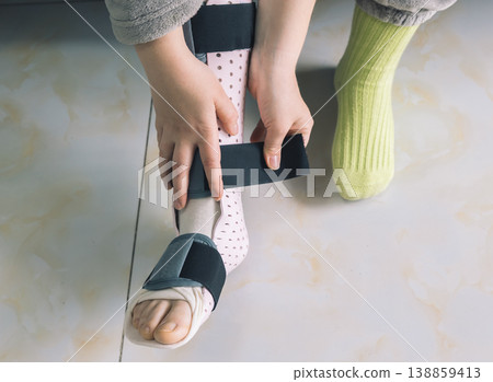 Applying a medical leg splint for injury recovery 138859413