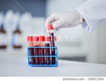 Hand, doctor and blood in test tube, health and sample for experiment with medical research in lab. Scientist, person and healthcare, check for virus or bacteria with scientific study and pathology Hand, doctor and blood in test tube, health and sample for experiment with medical research in lab. Scientist, person and healthcare, check for virus or bacteria with scientific study and pathology 138871569