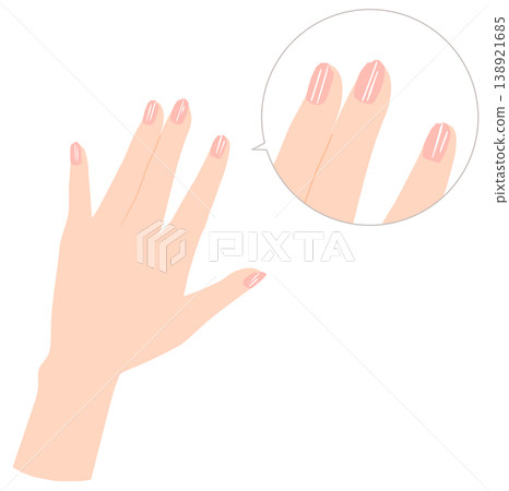 Illustration of damaged fingernails: cracks, chips, vertical lines Illustration of damaged fingernails: cracks, chips, vertical lines 138921685