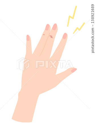 Illustration of damaged hands: chapped, cracked. Illustration of damaged hands: chapped, cracked. 138921689
