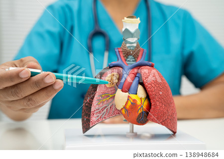 Pneumonia, lung cancer, Asian doctor holding human model. 138948684
