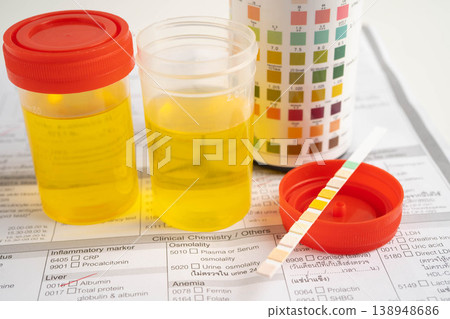 Urinalysis, urine cup with reagent strip pH paper test and comparison chart in laboratory. 138948686