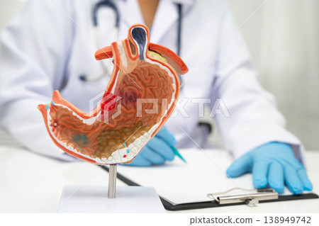 Stomach disease, doctor holding anatomy model for study diagnosis and treatment in hospital. Stomach disease, doctor holding anatomy model for study diagnosis and treatment in hospital. 138949742