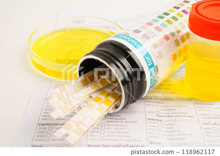 Urinalysis, urine cup with reagent strip pH paper test and comparison chart in laboratory. Urinalysis, urine cup with reagent strip pH paper test and comparison chart in laboratory. 138962117