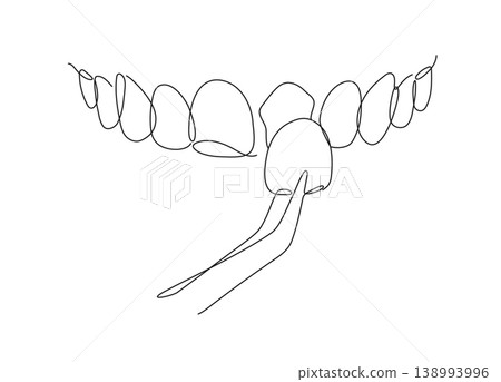 Ceramic veneers installation procedure for teeth silhouette thin lines white Ceramic veneers installation procedure for teeth silhouette thin lines white 138993996
