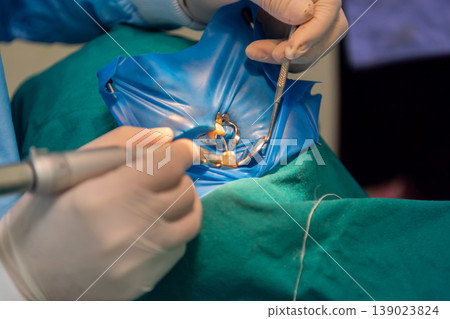 Close up dental procedure using tools and protective sheet dentist hands with gloves working on tooth in clinical environment healthcare treatment and hygiene concept 139023824