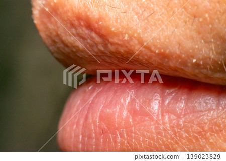 Close up of dry cracked lips and skin texture showing dehydration and health care concept detailed macro of human mouth area natural light Close up of dry cracked lips and skin texture showing dehydration and health care concept detailed macro of human mouth area natural light 139023829