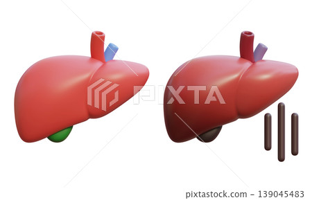 Healthy Liver and Sick Liver 3D Illustration Healthy Liver and Sick Liver 3D Illustration 139045483